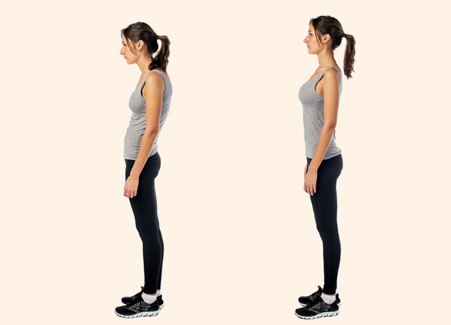 Posture Correction